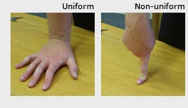 A photo of a person using their open hand to assert pressure to a hard surface with the text ‘Uniform’ above, and a second photo of pressure being asserted using the person’s middle fore-finger knuckle with the text ‘Non-uniform’ above