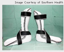Photo of foot orthosis 